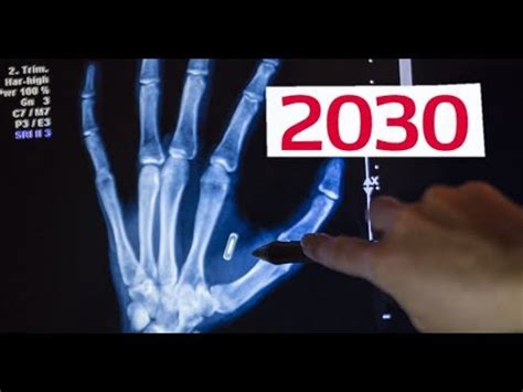 when will the rfid chip be implemented|are microchip implants mandatory.